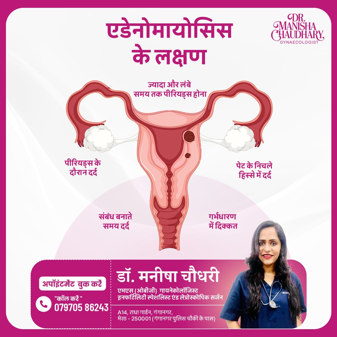 Dr. Manisha Chaudhary - Best Gynecologist, Obstetrician & Laparoscopic Surgeon in Meerut, Uttar Pradesh